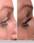 Obagi Nu-Cil Eyelash Enhancing Serum før og etter