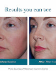Colorescience Barrier Pro™ Serum Spray Før og etter