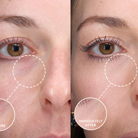 colorescience Total Eye® Firm & Repair Cream resultat