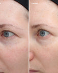 colorescience Total Eye® Firm & Repair Cream før og etter