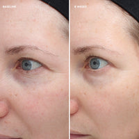 colorescience Total Eye® Firm & Repair Cream før og etter