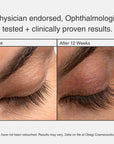 Obagi Nu-Cil Eyelash Enhancing Serum