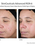 skinceuticals Advanced RGN-6 resultat