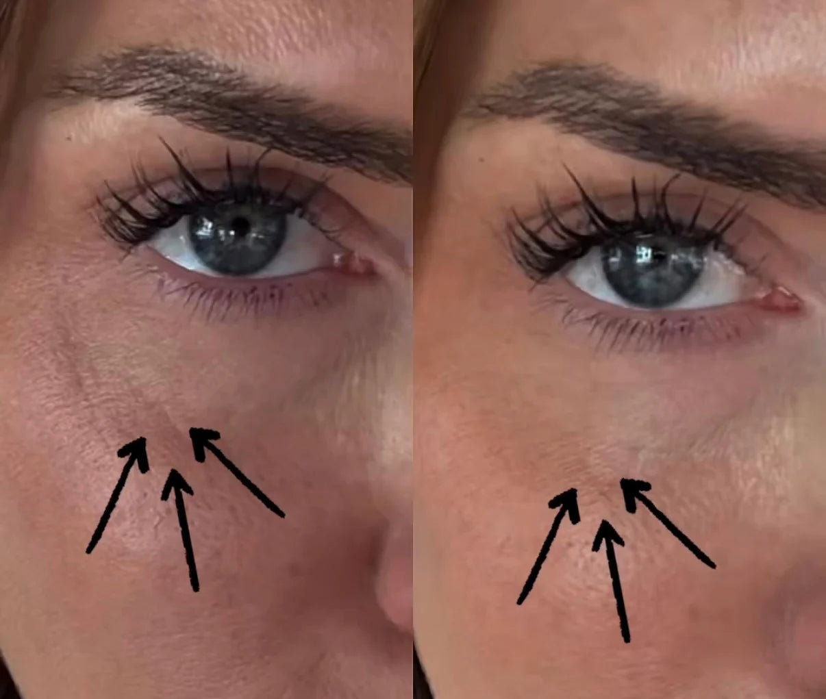 Face Formula Depuff Eye Stick før og etter