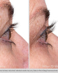 Obagi Nu-Cil Eyelash Enhancing Serum før og etter