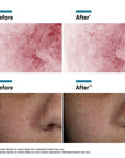 SkinCeuticals Phyto Corrective PDRN Serum Before and After