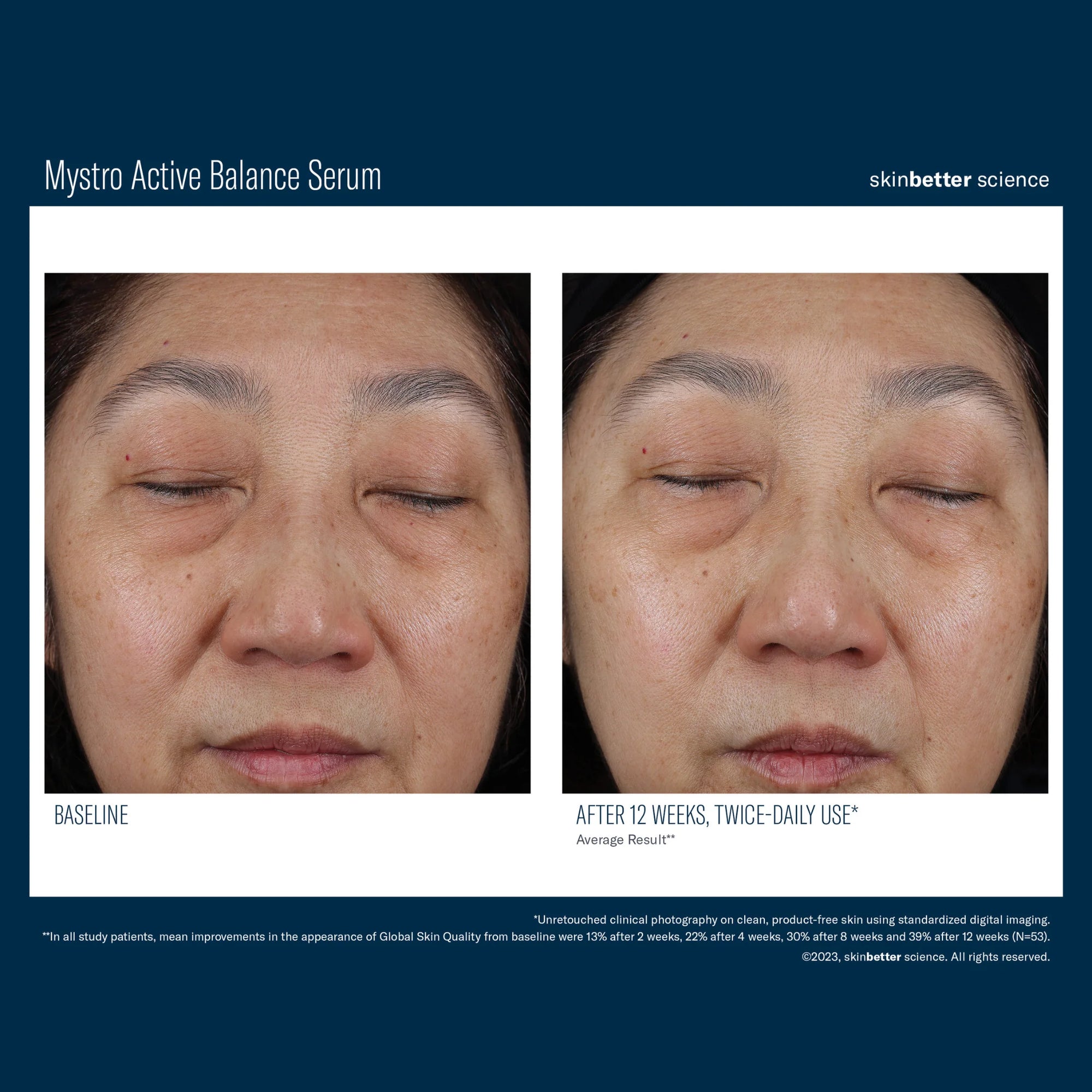 Skinbetter Mystro Active Balance Serum før og etter