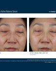 Skinbetter Mystro Active Balance Serum før og etter