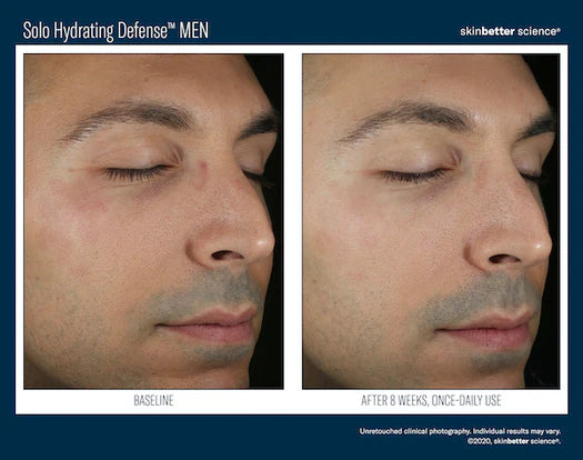 Skinbetter Solo Defense Serum Men Resultater