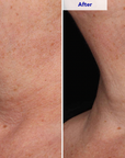 ZO Neck Complex Resultat