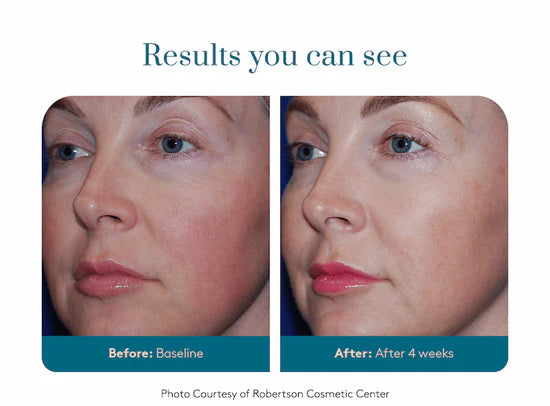 Colorescience Barrier Pro™ Serum Spray Før og etter