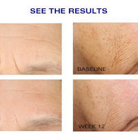 ZO Wrinkle And Texture Repair Resultat