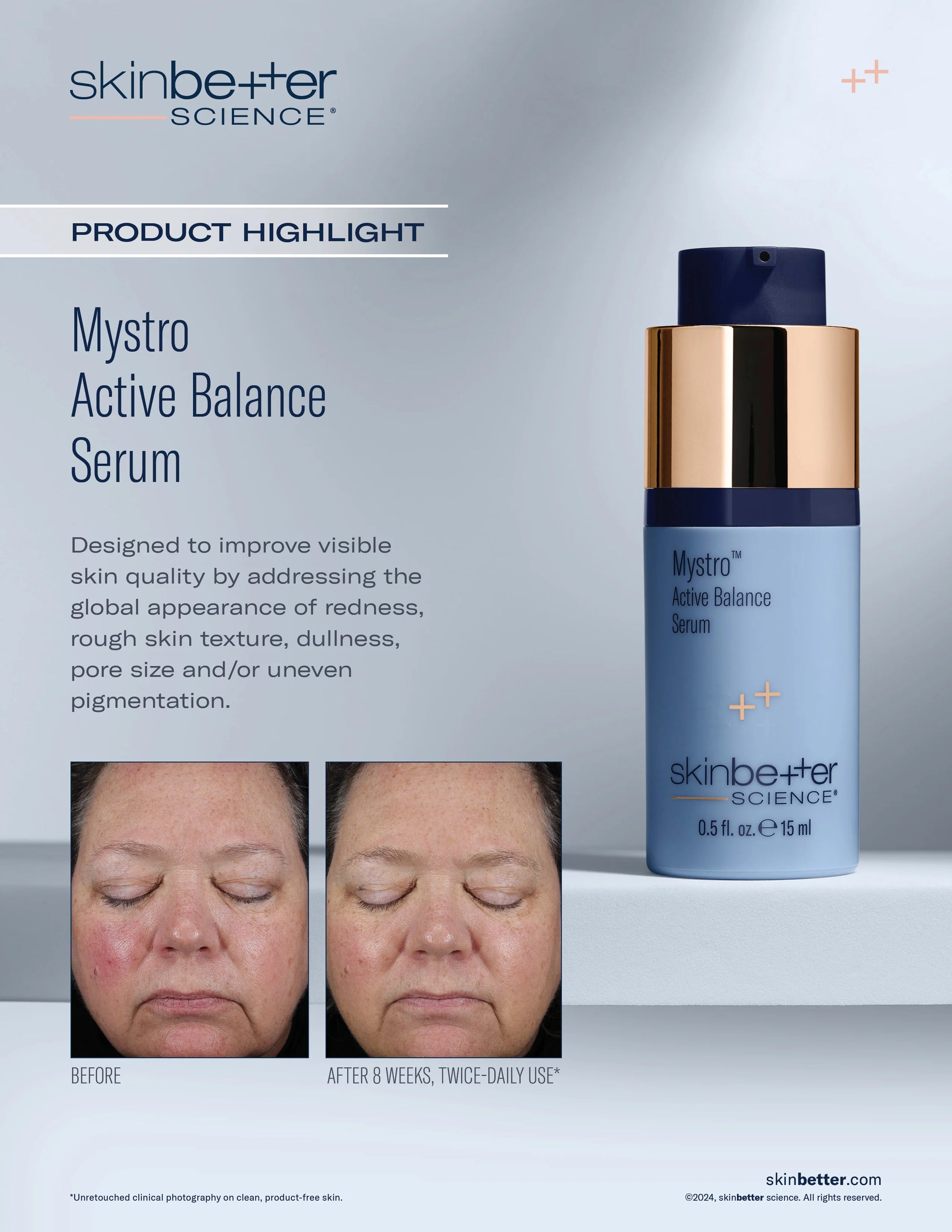 Skinbetter Mystro Active Balance Serum 