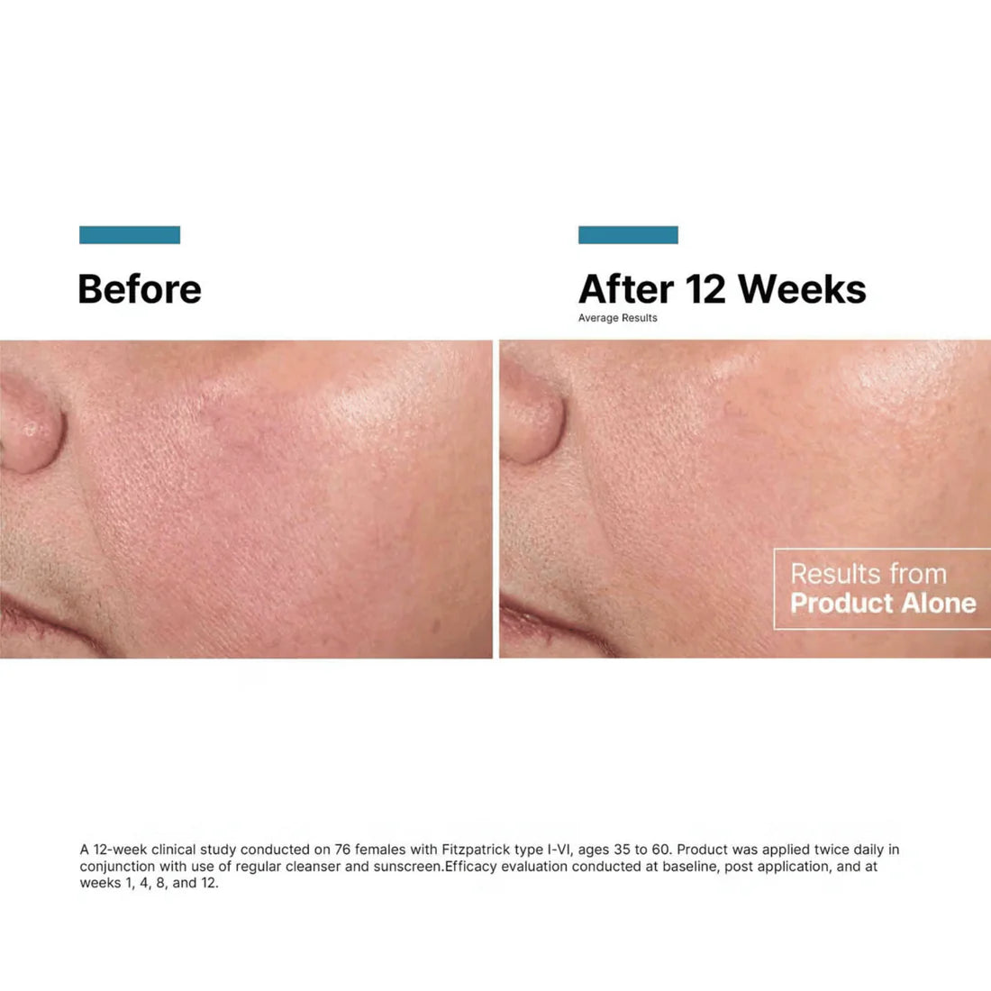 Skinceuticals Advanced RGN-6