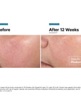 Skinceuticals Advanced RGN-6