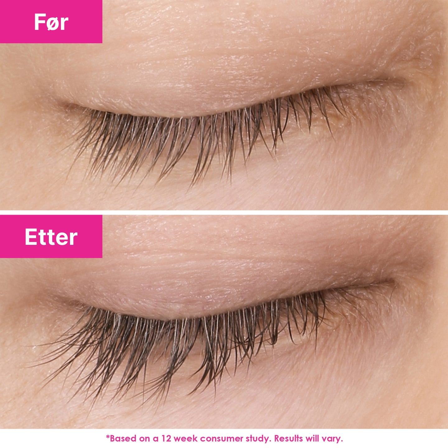 GrandeLASH-MD Lash Enhancing Serum resultat